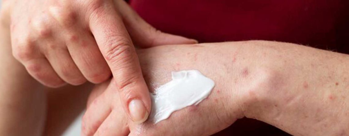 بهترین کرم ترمیم کننده زخم خارجی و ایرانی