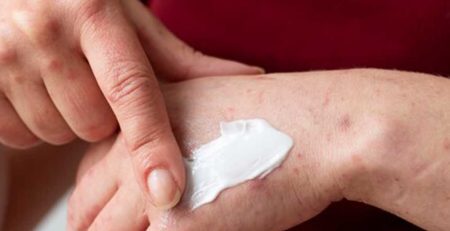 بهترین کرم ترمیم کننده زخم خارجی و ایرانی