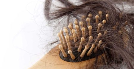 علت و درمان ریزش مو در شیردهی و پس از زایمان