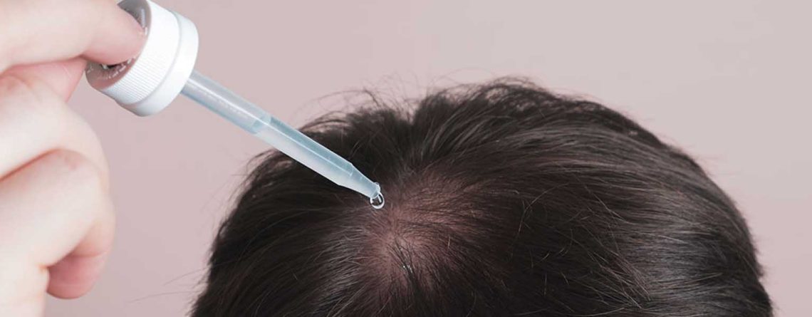 مایکنوکسیدیل برای مو (آشنایی با بهترین برندهای ایرانی و خارجی)