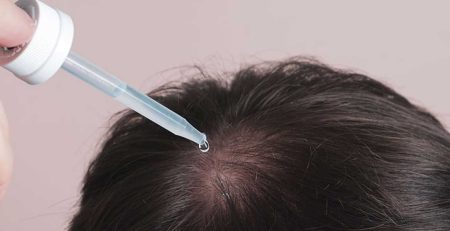 مایکنوکسیدیل برای مو (آشنایی با بهترین برندهای ایرانی و خارجی)