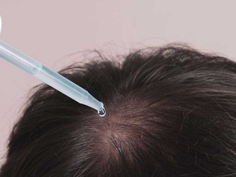 مایکنوکسیدیل برای مو (آشنایی با بهترین برندهای ایرانی و خارجی)